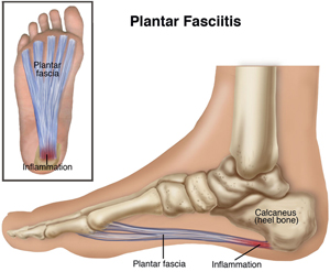 ankle heel pain